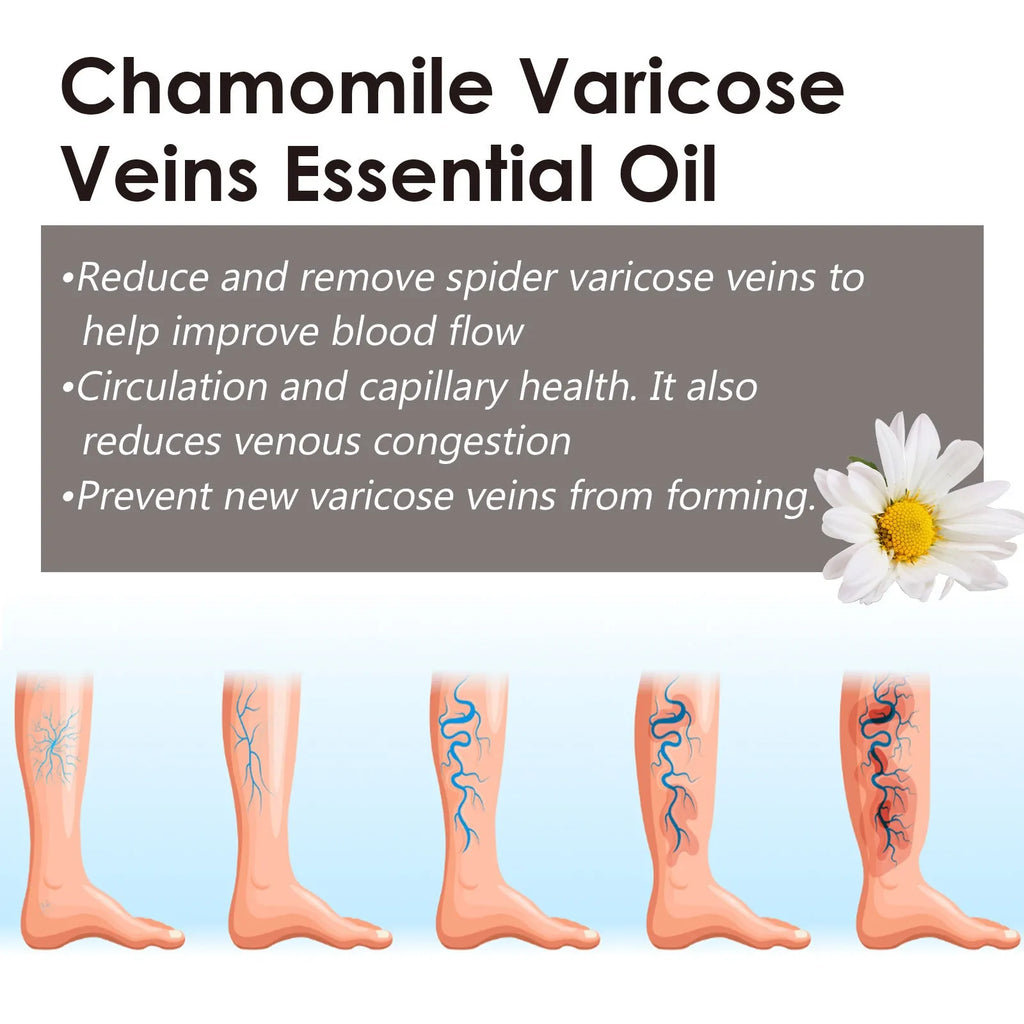 10ml bottle of chamomile leg essential oil with dropper for massage and skin care.