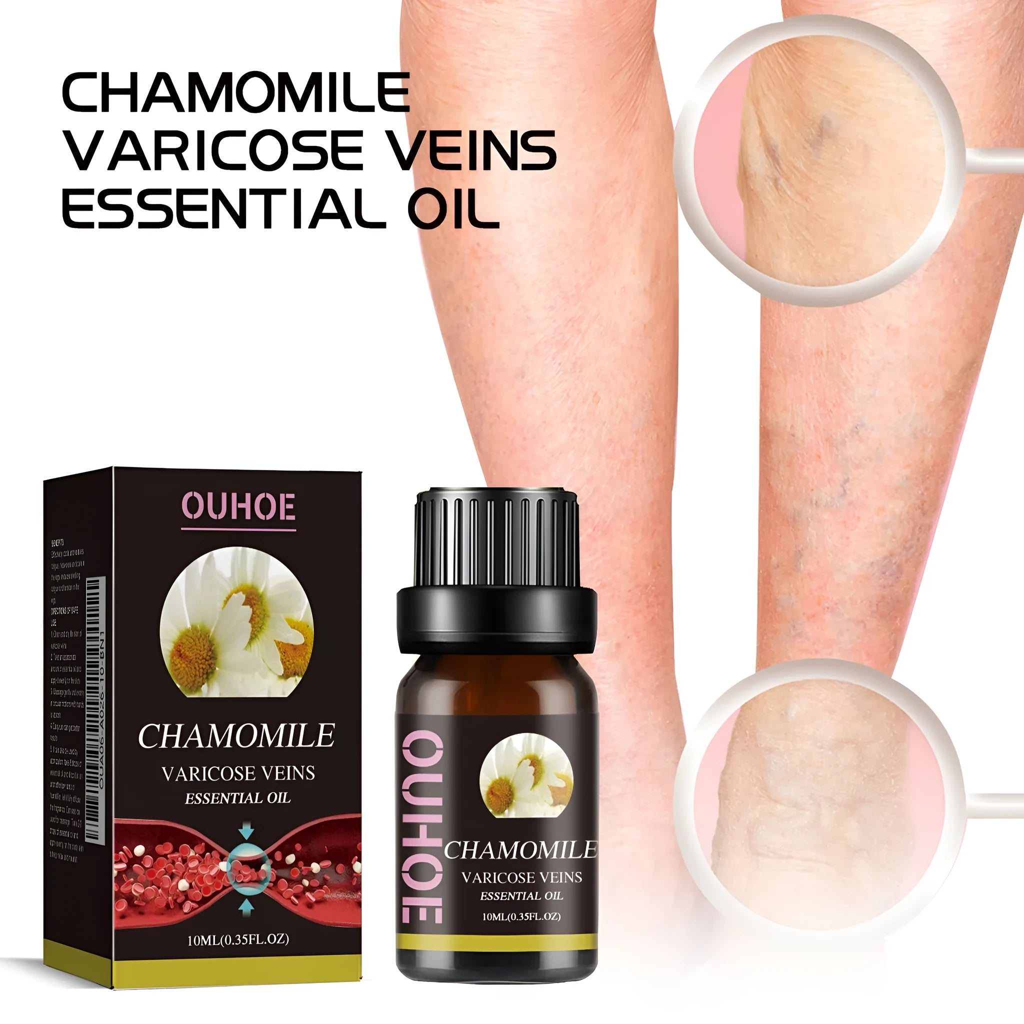10ml bottle of chamomile leg essential oil with dropper for massage and skin care.