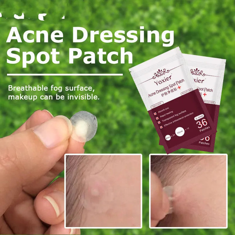 Acne dressing spot patch 0.1mm invisible sticker in red colour with 36-count pack