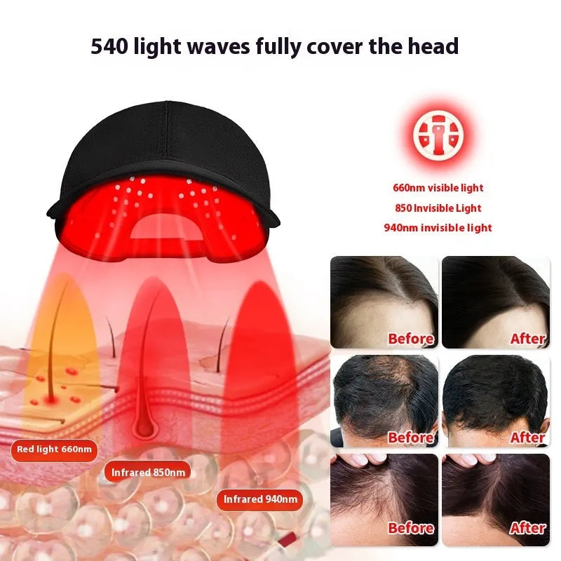 Black infrared duckbill hair growth cap with red LED lights and separate controller on table