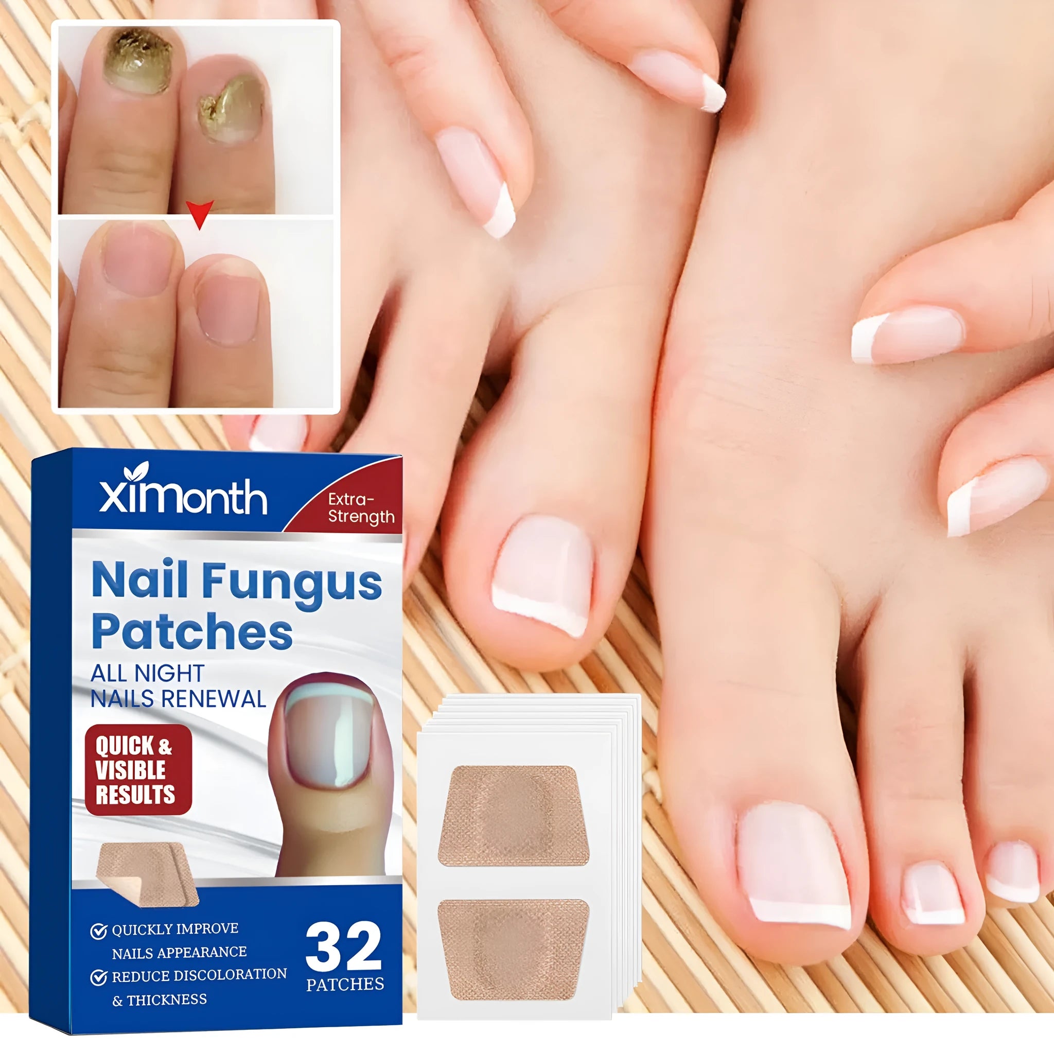 Box of 32 nail nursing adhesive bandage repair patches for damaged nails.