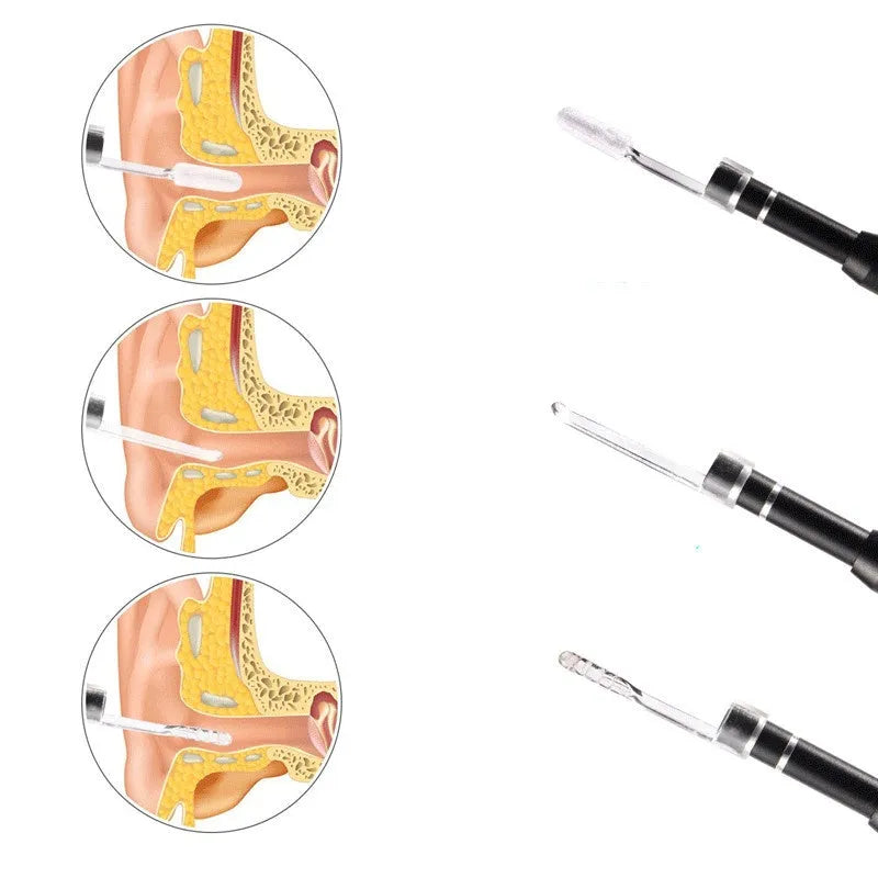 5.5mm ear endoscope XMZ-009 with LED light and three-in-one ear spoon attachment for visual ear inspection