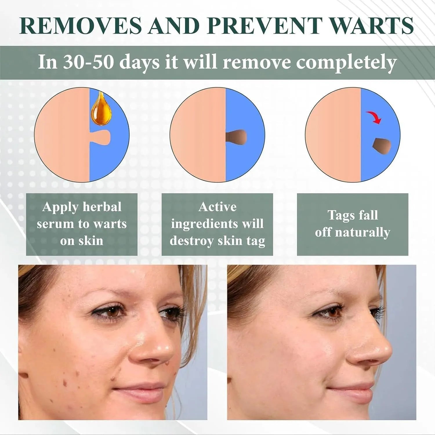 Natureerase Instant Mole Spot Removal Gel in 45g packaging with hydrating properties