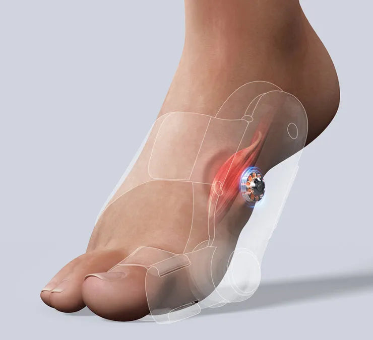 White plastic electric hallux valgus toe separator with USB Type-C charging cable.