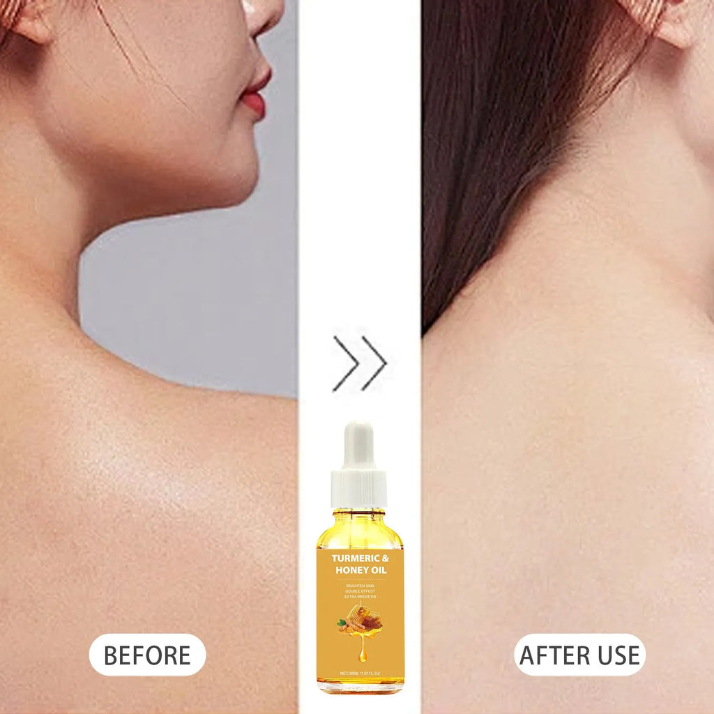 30ml turmeric honey essential oil bottle in white packaging for facial skincare