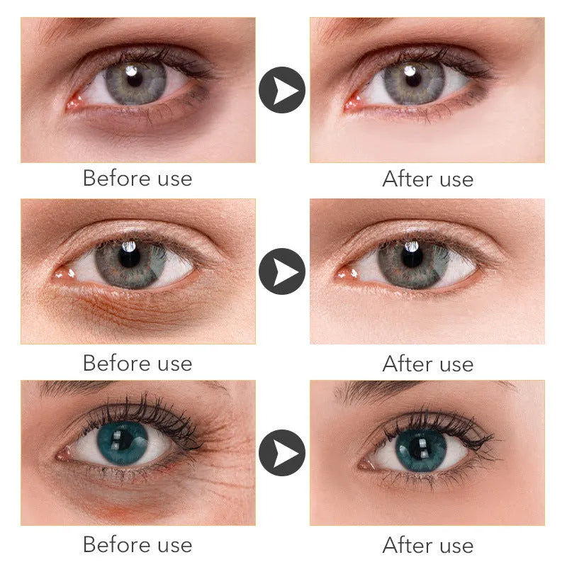 30ml Beauty Eye Cream in skincare packaging for anti-ageing eye treatment