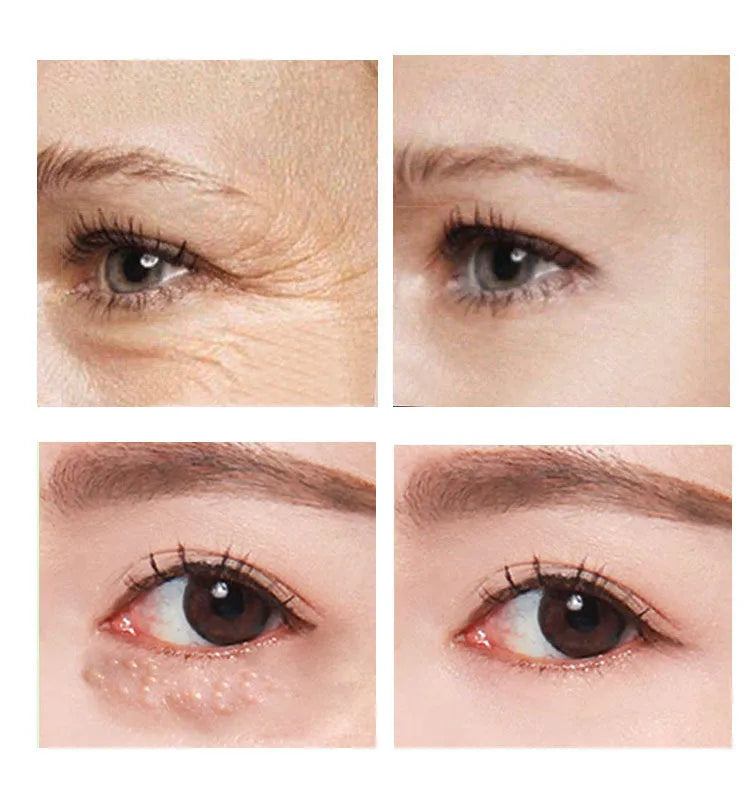 30ml Beauty Eye Cream in skincare packaging for anti-ageing eye treatment